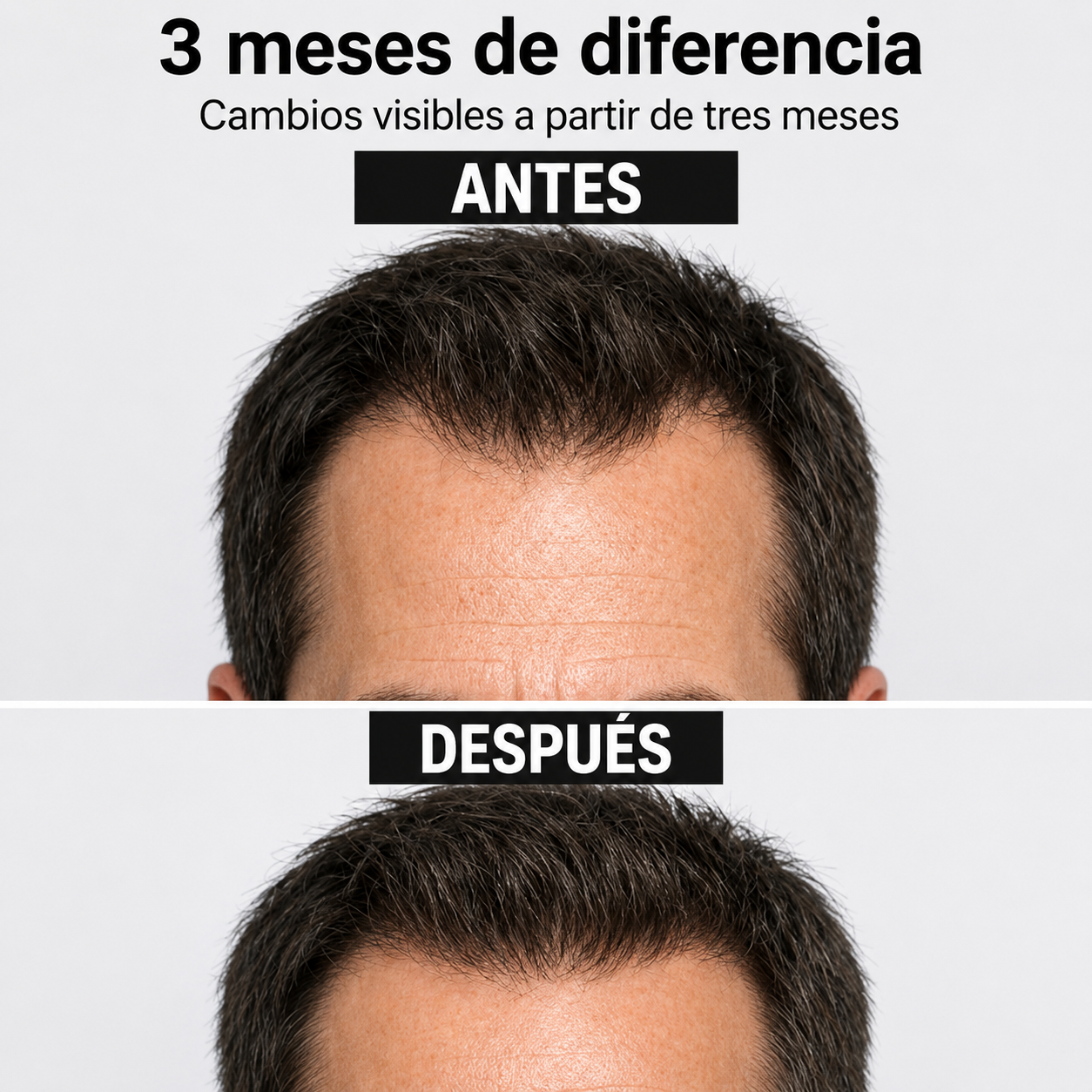 ✨ El dúo imprescindible para el cuidado de tu cabello. Tú Kit Completo de Aceite de Ricino y Aplicador Masajeador